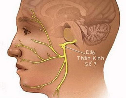Điều trị bệnh liệt dây thần kinh tại Tây Ninh